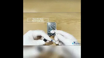 Digital Apex Locators Automatic Calibration For Root Canal Therapy